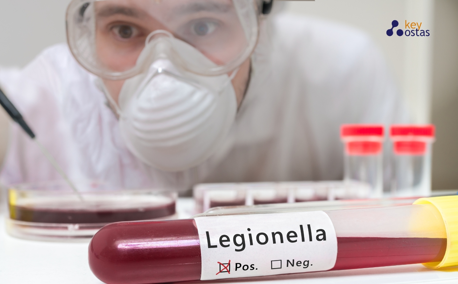 lab worker testing for legionella